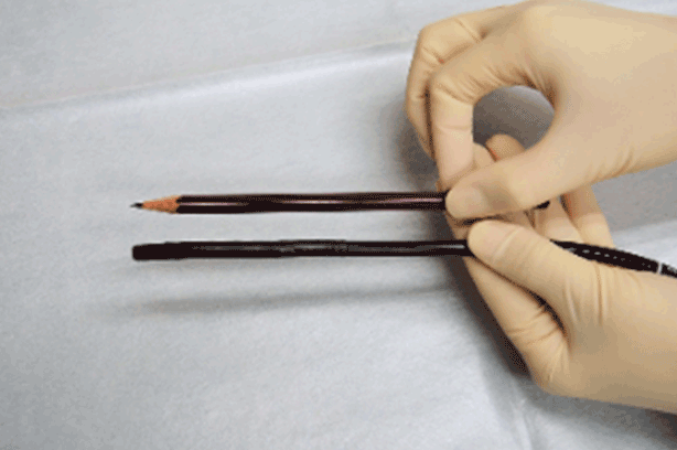 胃内視鏡検査とは